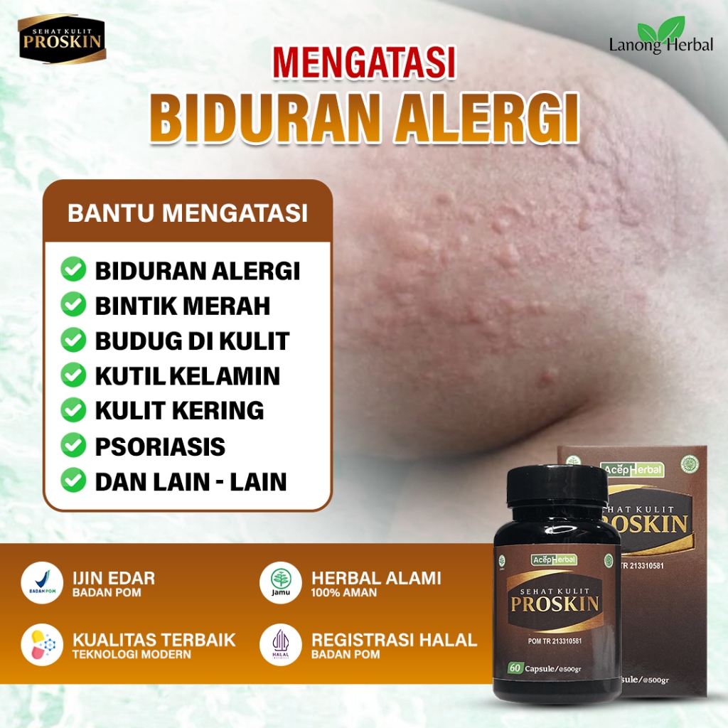 PROSKIN Kapsul Binahong Obat Biduran Gatal Kulit Selangkangan Jamur Panu Hapuran Kurap Kutu Air PALI