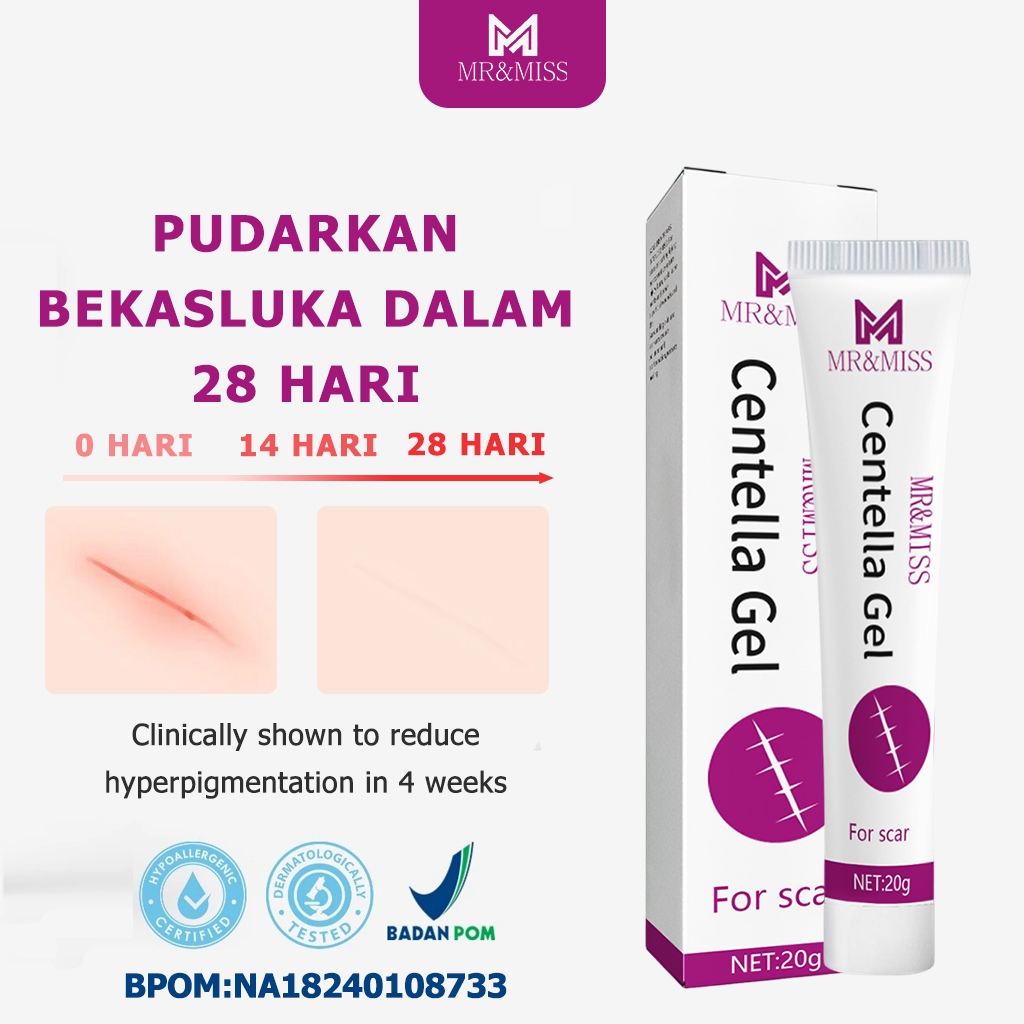 Penghilang bekas luka hitam koreng Obat penghilang bekas luka Penghilang bekas luka Salep penghilang