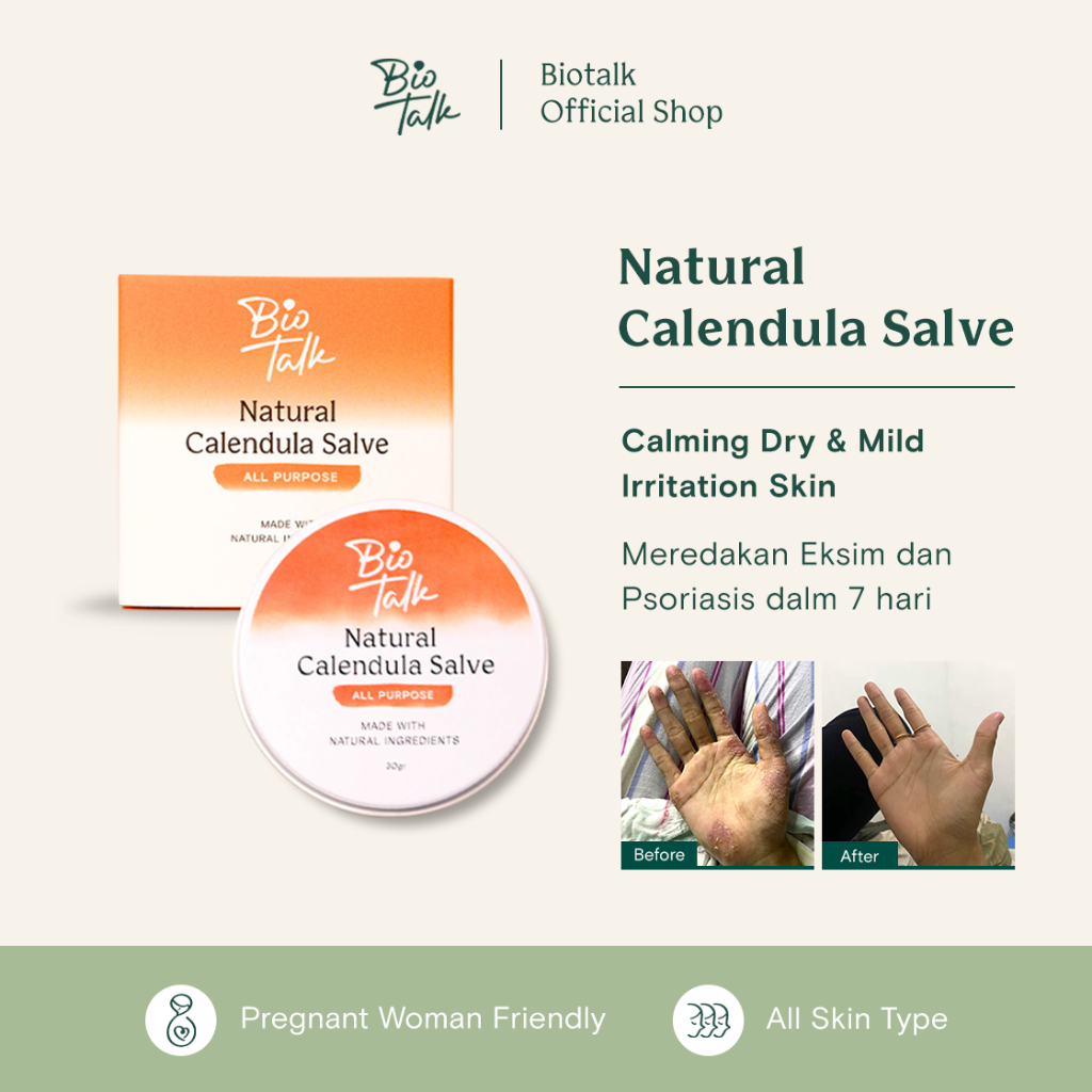[SPECIAL PROMO] Biotalk Natural Calendula Salve