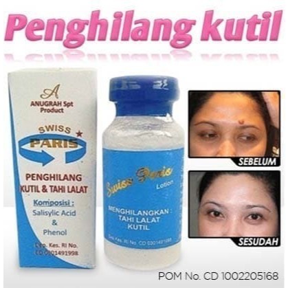 SWISS PARIS Salep Kutilat Salep Penghilang Kutil dan Tahi Lalat Permanen