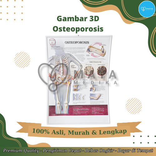 

Gambar 3D Anatomi PT Innovation