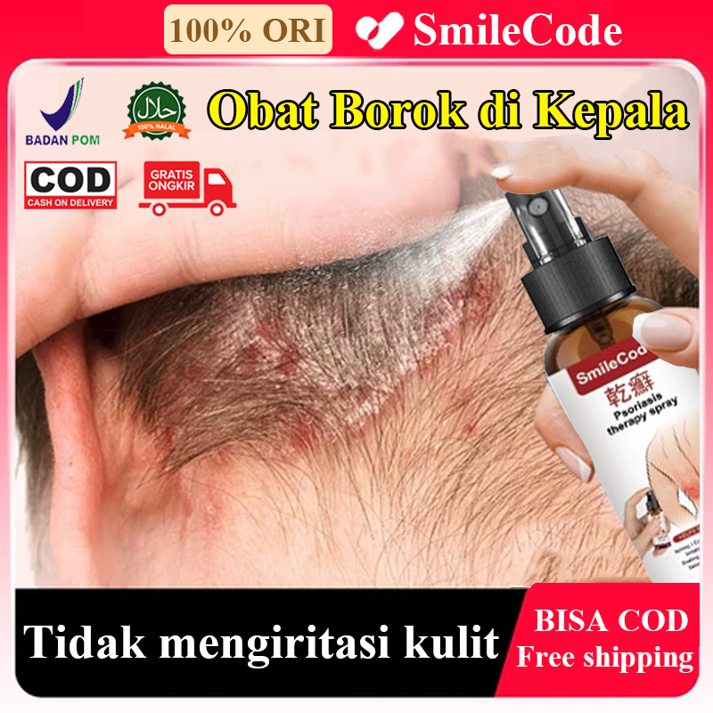 BPOM Obat Penghilang Gatal di Kulit Kepala Akibat Infeksi Jamur, Obat Borok di Kepala, Ketombe Parah