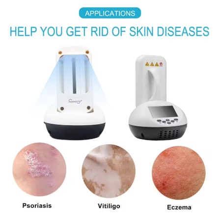 SOF Peralatan Terapi Fisik Lampu UVB, Lampu Fototerapi Pita Sempit, Lampu Psoriasis Sumber Cahaya Me