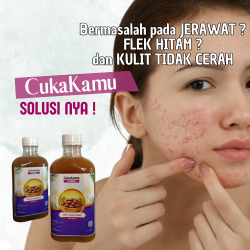 

Cerahkan Wajah dan Basmi Flek Hitam dengan Cuka Kurma 100% Kurma Alami - ORIGINAL 1 Botol