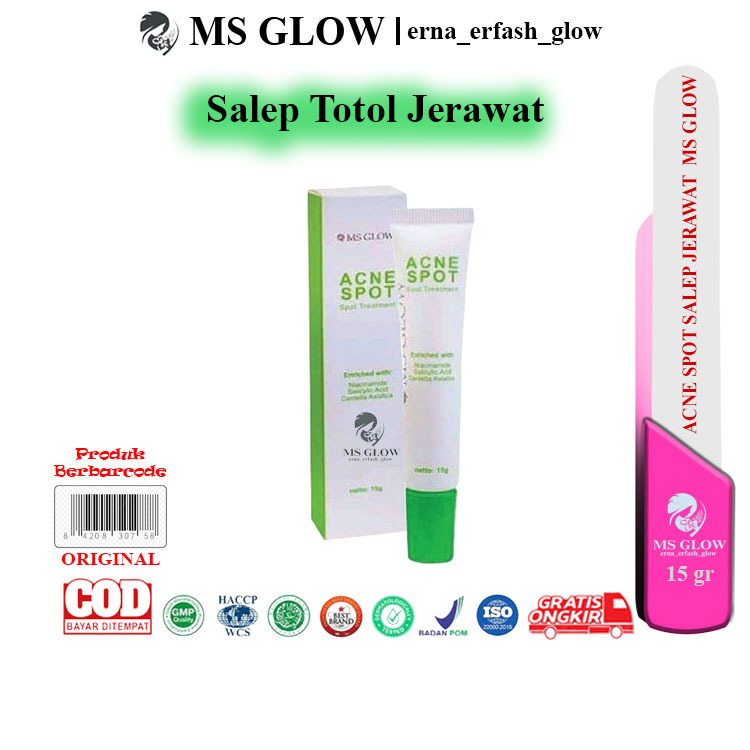 ACNE SPOT MS GLOW SALEP TOTOL JERAWAT