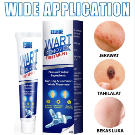 COD - EELHOE WART REMOVER CREAM PENGHILANG TAHI LALAT