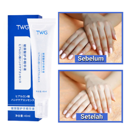 Twg Serum Tangan Hyaluronic Acid Serum Tangan Keriput Dan Kasar Pemutih Tangan Perawatan Tangan