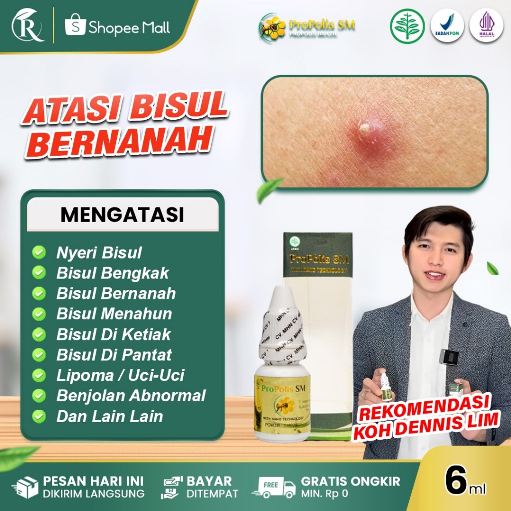 PROPOLIS SM Obat Bisul Bengkak Bernanah Di Ketiak Pantat Kepala Bisul Menahun Anak dan Dewasa