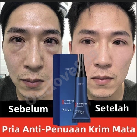 ORI Serum Gel Pengencang Mata Anti Penuaan Pria Retinol Anti-Penuaan Krim Mata Treatment Mata Cream 