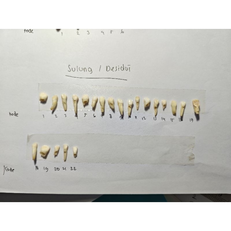 Gigi Asli | Gigi Desidui | Gigi Sulung | Gigi Anak | Gigi Praktikum