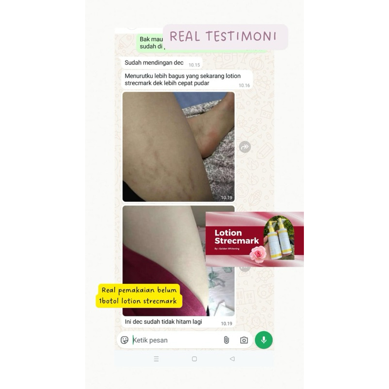 HB STERCMAK GOLDEN whitening