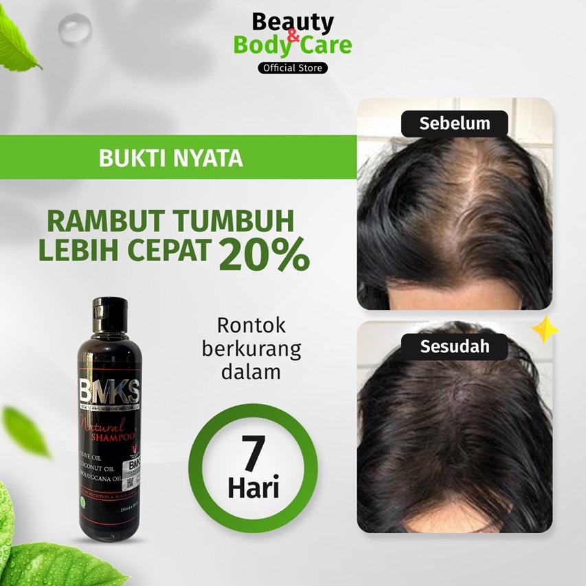 Super Stok  HairCare Original 1 Penumbuh Penyubur Perawatan Rambut Botak Dan Rontok Parah Pria Wanit