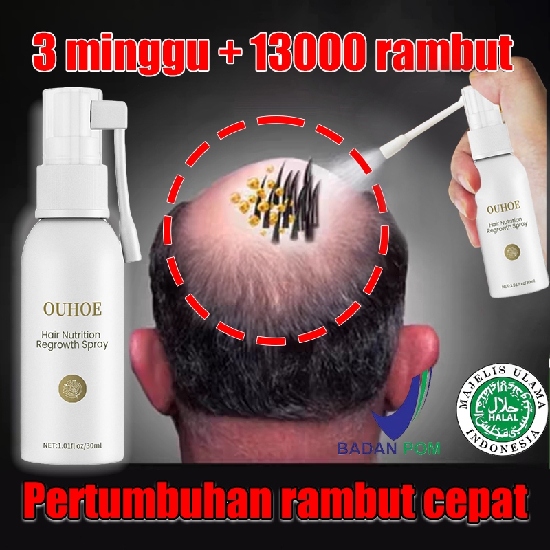 Obat penumbuh rambut Serum penumbuh rambut botak Penumbuh rambut Cepat 30ML serum rambut rontok Penu