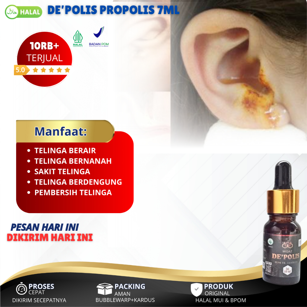 Obat Tetes Telinga, Obat Tetes Telinga Berair, Obat Tetes Telinga yang Aman, Obat Tetes Telinga Berd