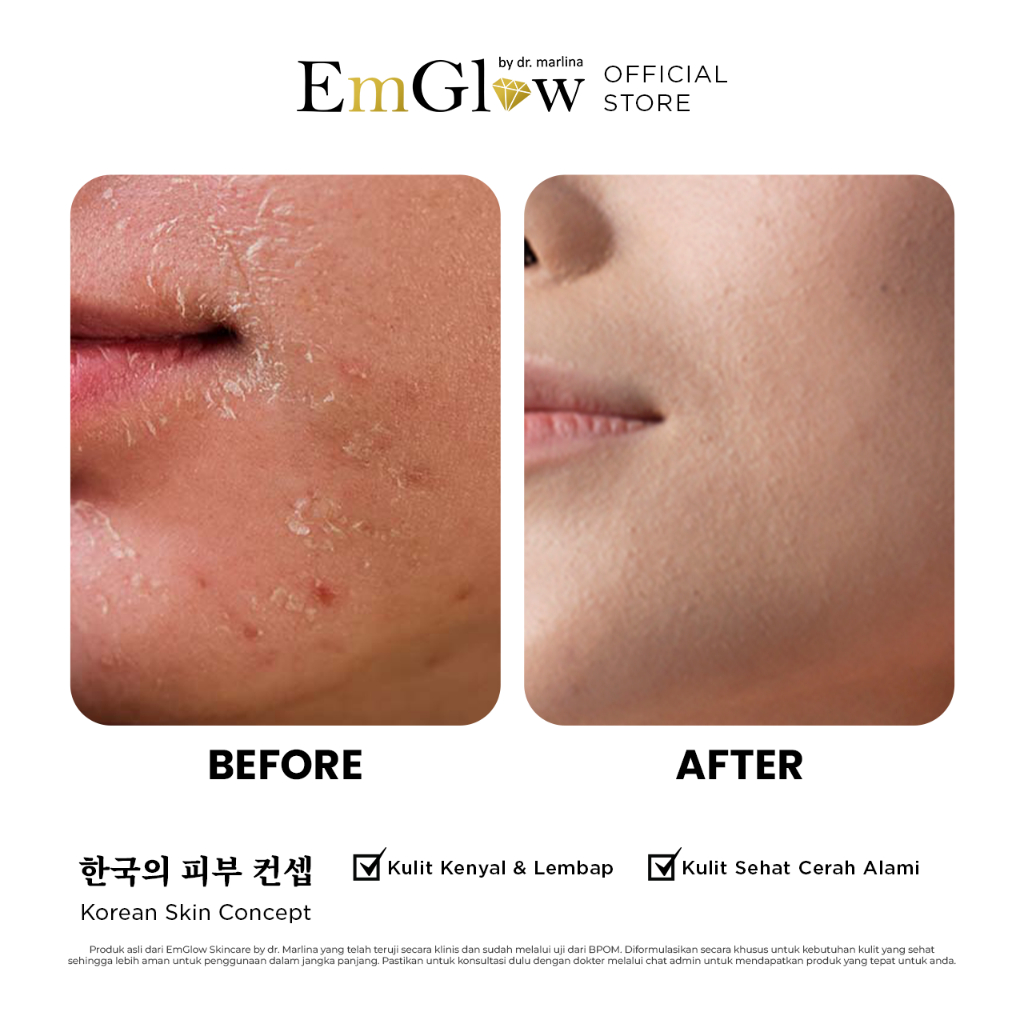 EmGlow - NUTRI MOIST CREAM Amino Ceramide Melembabkan Kulit Kering, Sensitif & Mencegah Iritasi