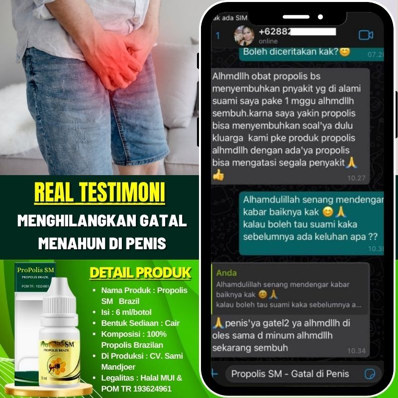 Obat Oles Gatal Buah Zakar Pria 100% Alami, Obat Lecet di Buah Zakar, Bentol - Bentol Bernanah di Bu