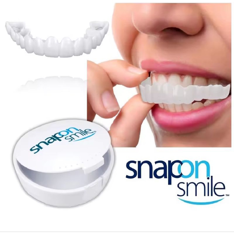 Snap On Smile Gigi Palsu 1 Set Atas Bawah | SNAP ON SMILE Veeners Gigi Palsu 1 Pasang | Gigi Palsu T