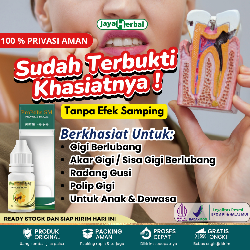 Obat Sakit Gigi Berlubang Akar Gigi Berlubang Sakit Gigi Agar Cepat Sembuh Penghilang Sisa Gigi Berl