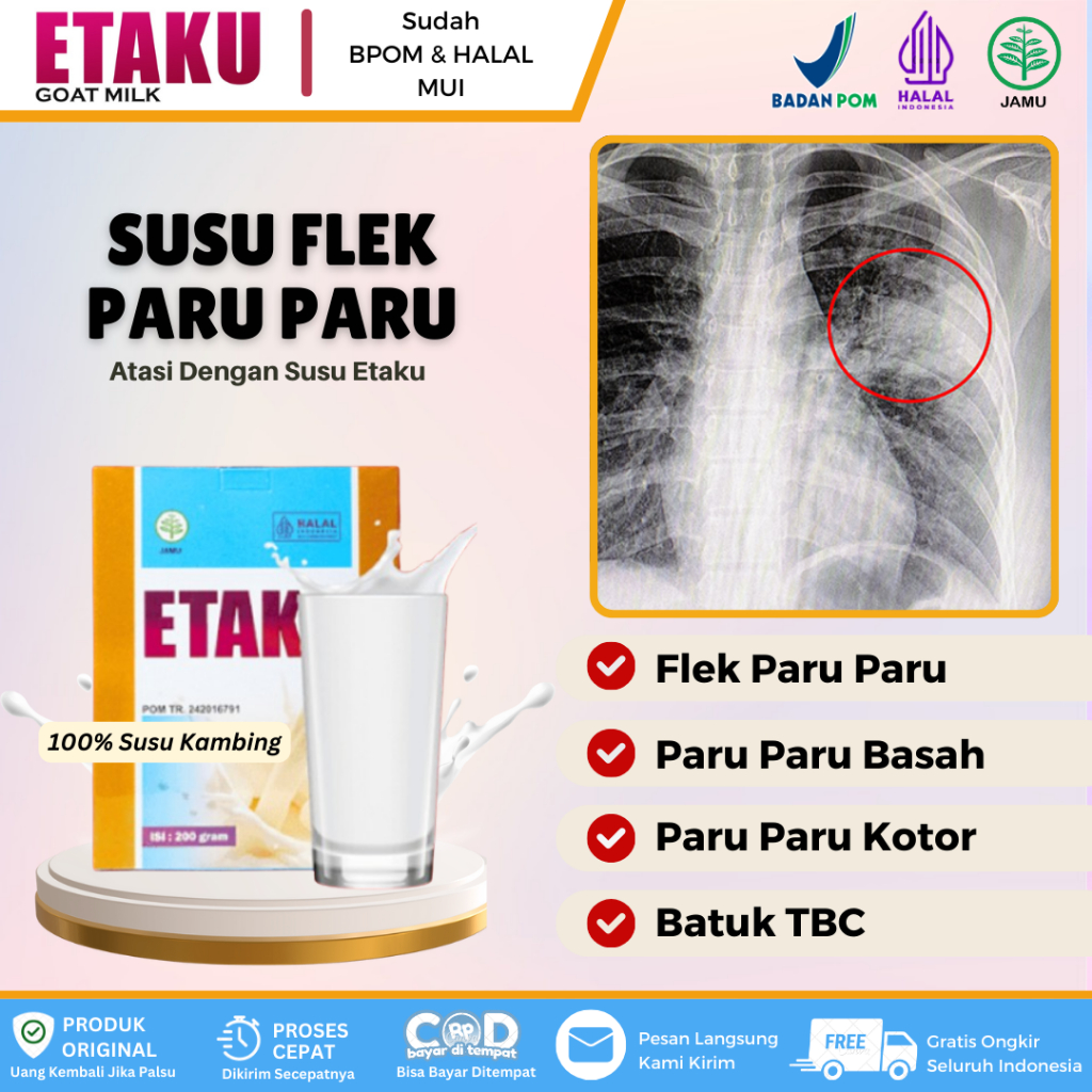 

Susu Etaku - Untuk Flek Paru Paru, Batuk TBC, Infeksi Paru, Bronkitis, Pneumonia, Pembersih Paru Paru, Flek Paru Paru Anak & Dewasa Dengan Susu Etaku HALAL BPOM