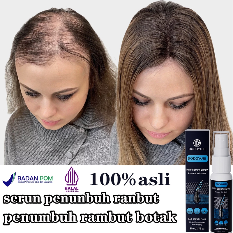 Obat penumbuh rambut pelebat rambut penumbuh rambut cepat Serum penumbuh rambut 30ml penumbuh rambut