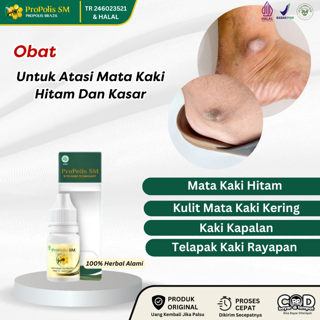 Obat Mata Kaki Hitam, Obat Kaki Kapalan, Obat Mata Kaki Hitam Dan Kasar, Obat Oles Mata Kaki Hitam D