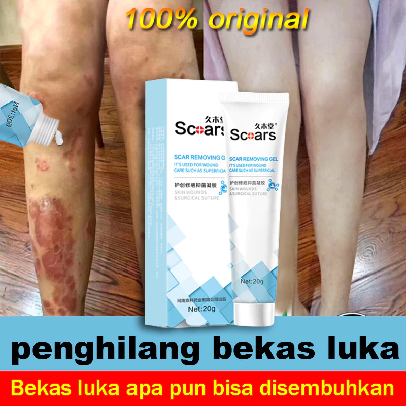 Obat Penghilang bekas luka hitam koreng Penghilang bekas gigitan nyamuk bekas luka Jerawat