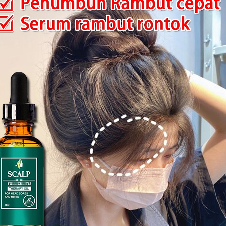 Serba Populer  Minyak Esensial Perawatan Rambut Rontok Rambut Rusak Serum Essential Oil Cepat Hair T