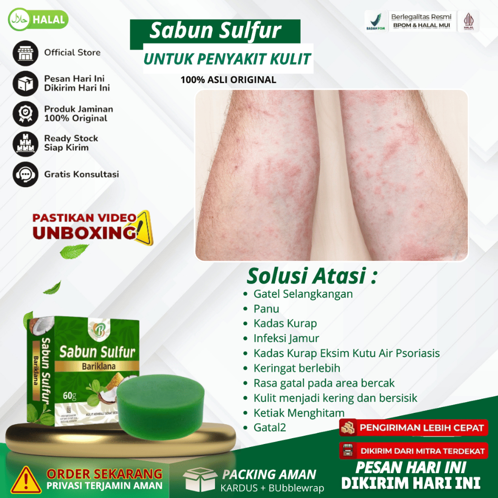 Sabun Sulfur - Sabun Binahong Obat Gatal Kulit Jamur Panu Hapuran Kadas Kurap Eksim Kutu Air Psorias