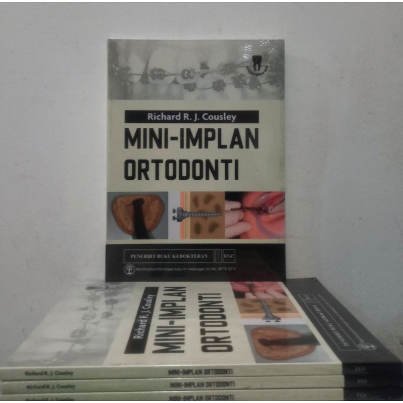 Mini-Implan Ortodonti