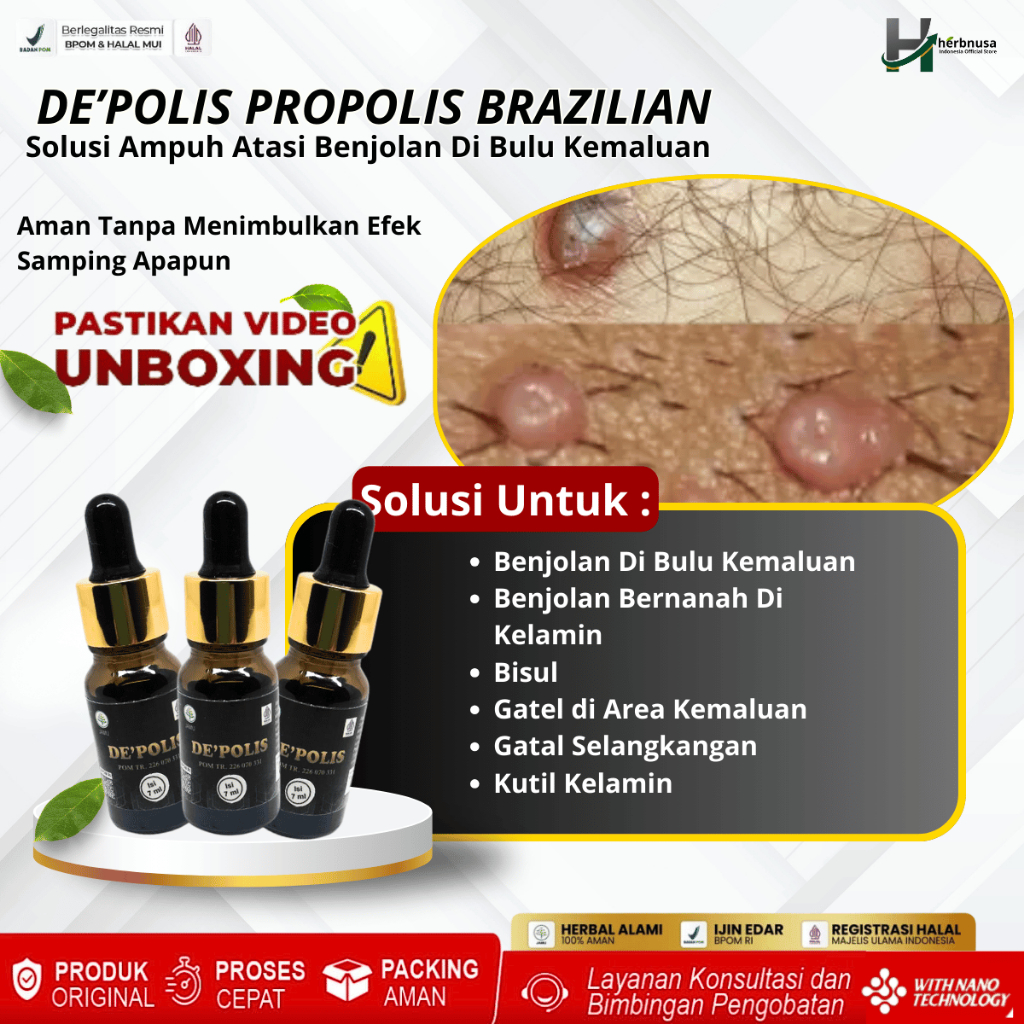 Obat Benjolan Di Bulu Kemaluan, Obat Mengempeskan Benjolan Kelamin Pria & Wanita, Obat Benjolan Bern