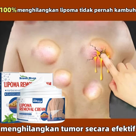Lipoma Removal Cream 50g Herbal Cina Krim Obat Benjolan Lipoma Obat Lipoma Perawatan Punggung/Leher/