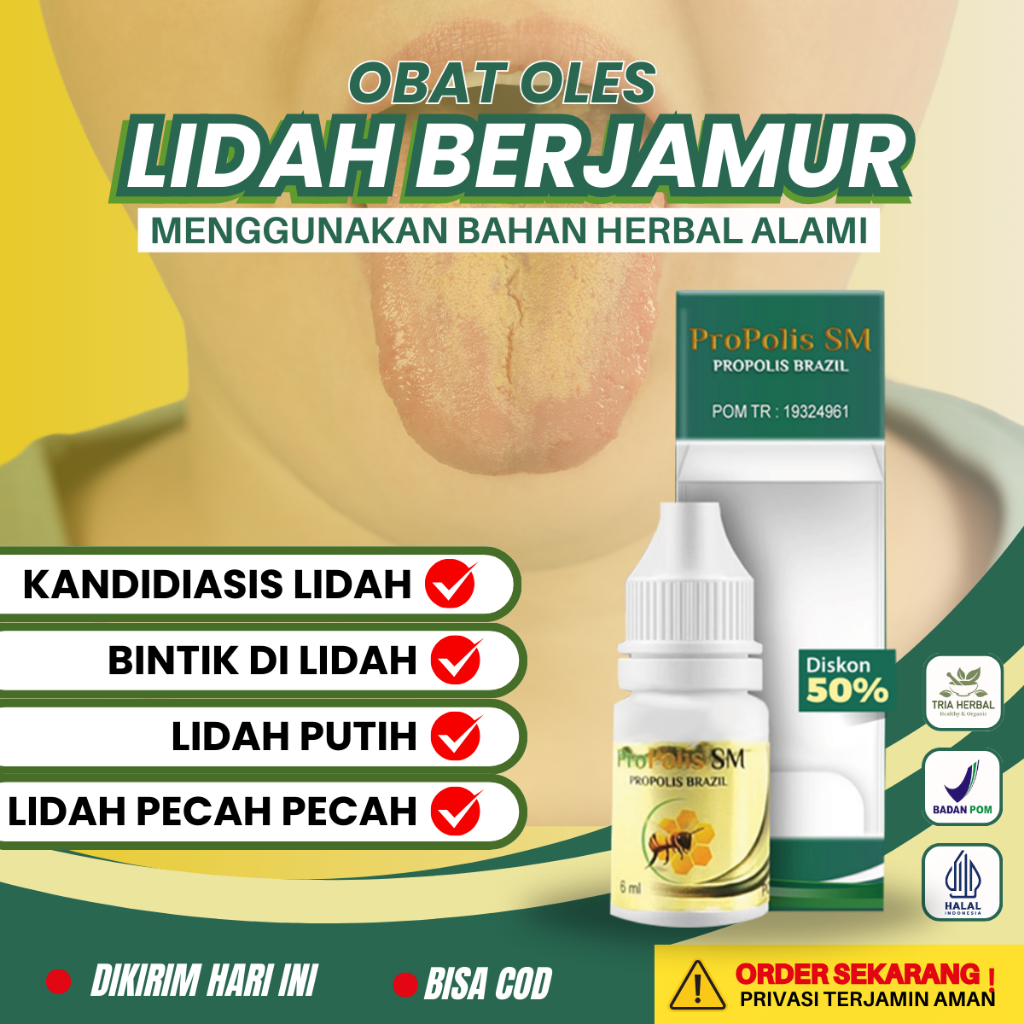 Obat Kandidiasis Mukokutan, Obat Lidah Putih Lidah Pecah Pecah, Obat Lidah Berjamur, Obat Lidah Mati