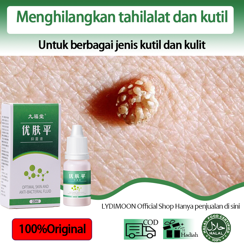 Obat kutil Obat kutil kelamin Obat kutil wajah Penghilang kutil Obat kutil di leher Calusol obat mat