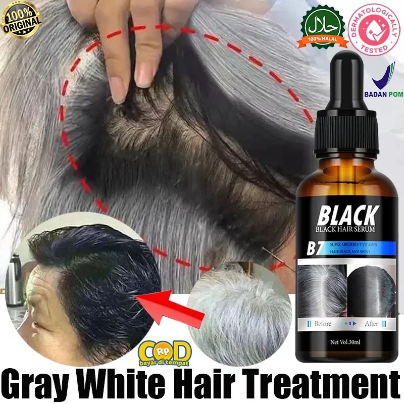Black Hair Serum Natural Perawatan Rambut Anti Uban Penghilang Uban Permanen Di Usia Muda Penutup Ra