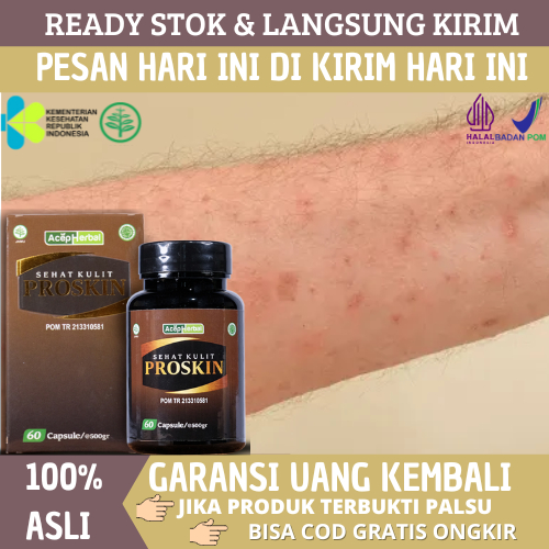 Obat Gatal, Obat Budug, Obat Borok, Oba Gatal Bernanah, Obat Budug Bernanah, Eksim, Kutu Air, Herpes