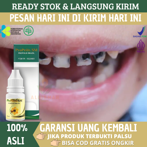 Obat Gigi Keropos Dan Menghitam, Obat Gigi Rusak Dan Karang Gigi Menghitam, Obat Tetes Sakit Gigi - 