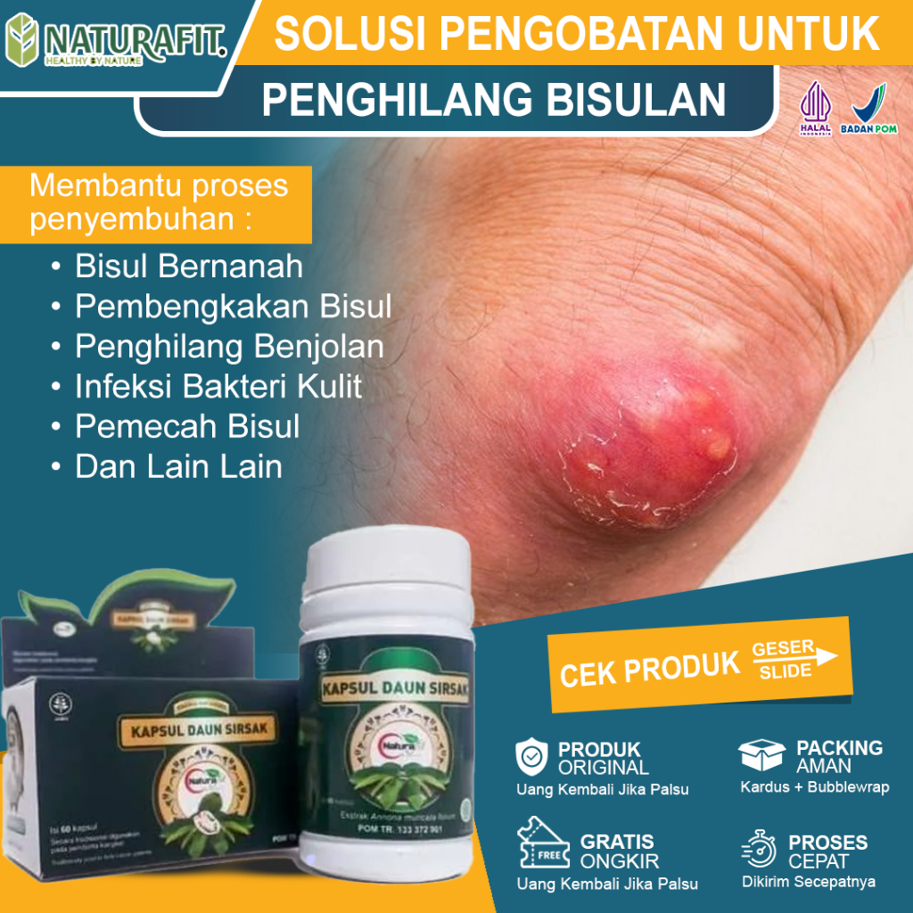 Obat Bisul Paling Ampuh Bisulan Penghilang Benjolan Agar Cepat Pecah Bisul Di Pantat Bengkak Bernana