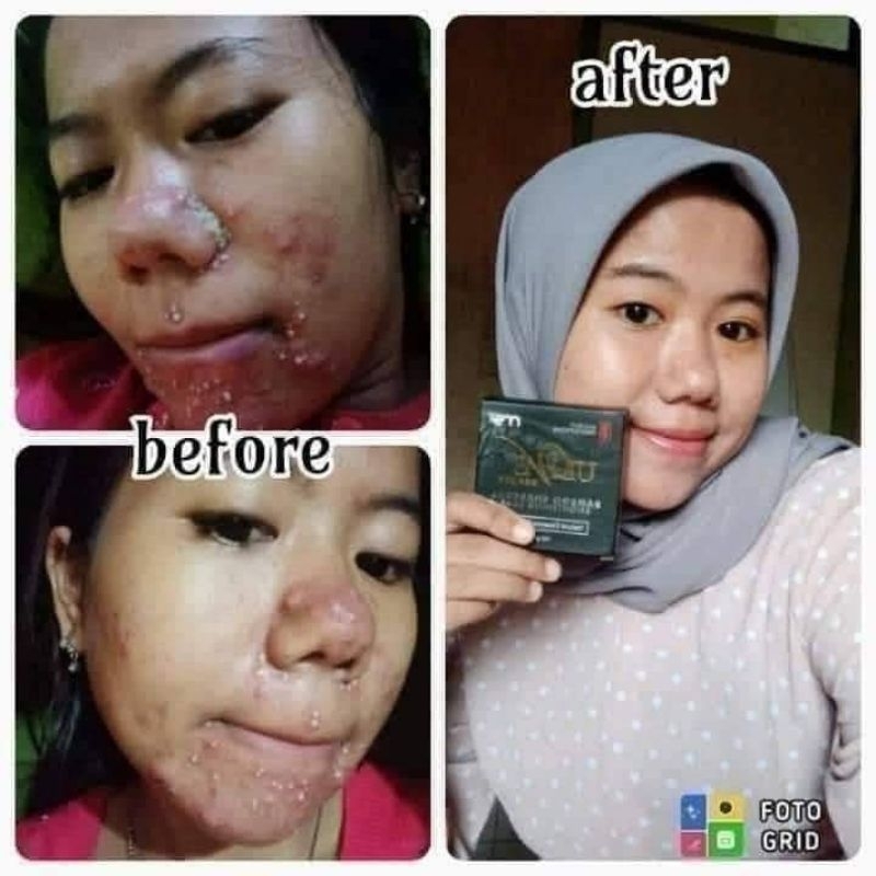 Sabun Bamboo MSI Original //Sabun Hilang kan jerawat dan gatal², mencerahkan dan menghaluskan kulit 