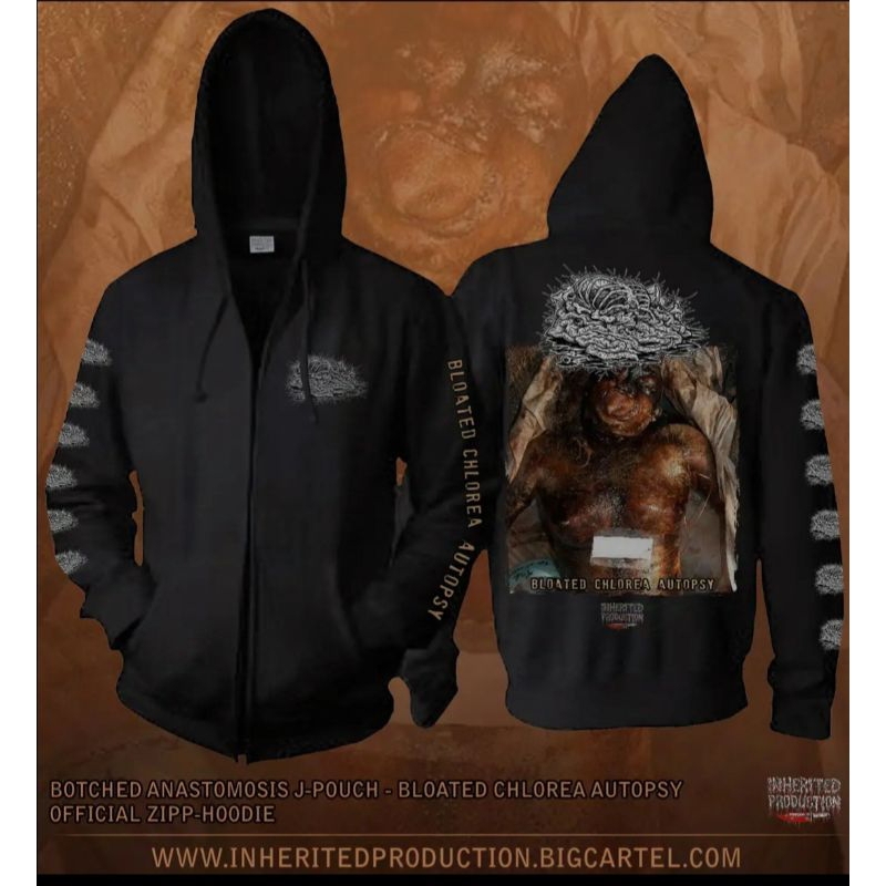 ZIPER BOTCHED ANASTOMOSIS JPOUCH FROM UNITED STATES