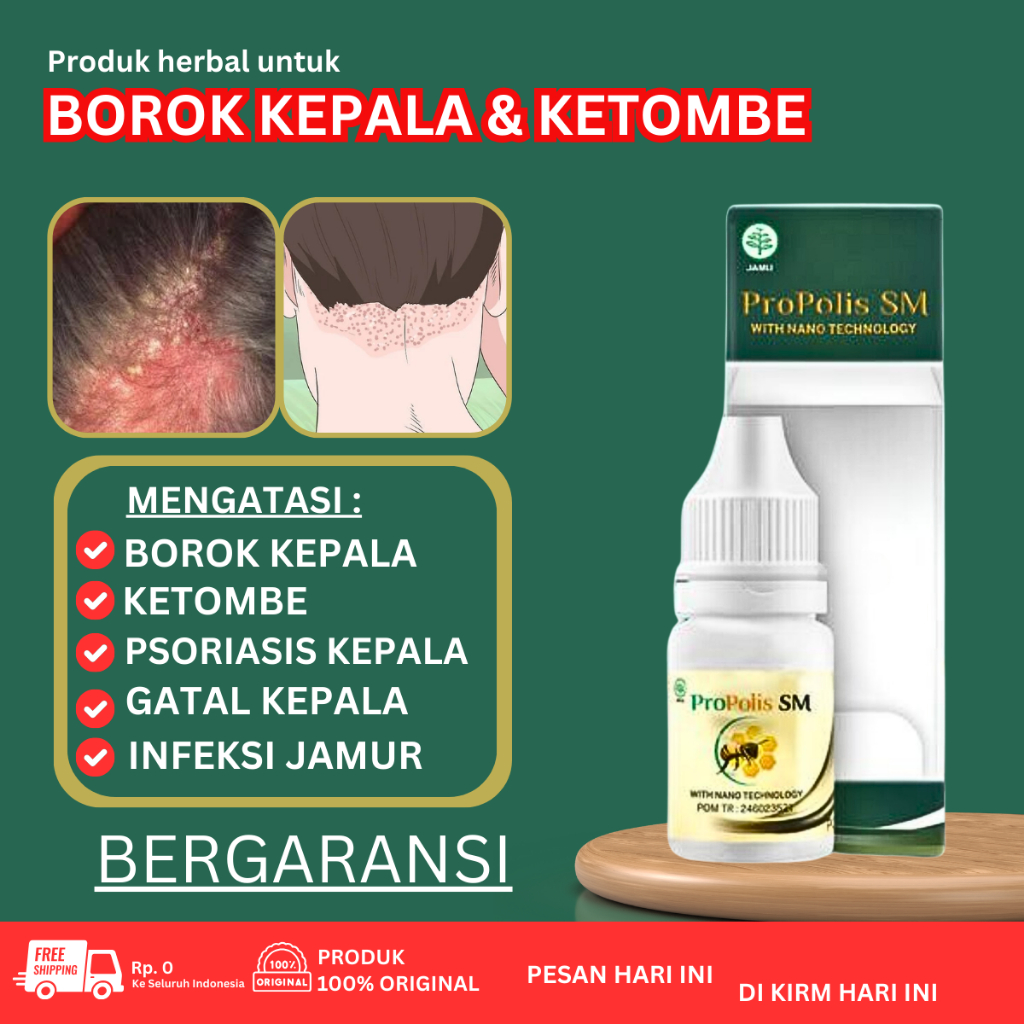 Salep Borok Kepala - Obat Psoriasis Kulit Kepala - Obat Kepala Berkerak Ketombe Parah - Obat Borok K