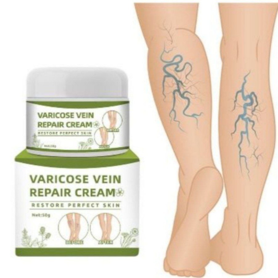 Obat Varikokel Salep Varises 50G Obat Varises varicose Veins cream varises Paling ampuh Original