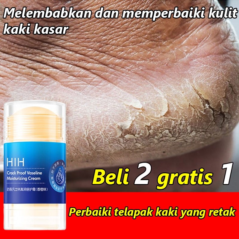 Ay00 Vaseline Pelembab Kaki Pecah Tumit Kaki Pecah Dan Kering Tangan Kapalan Amplas Kaki Pecah