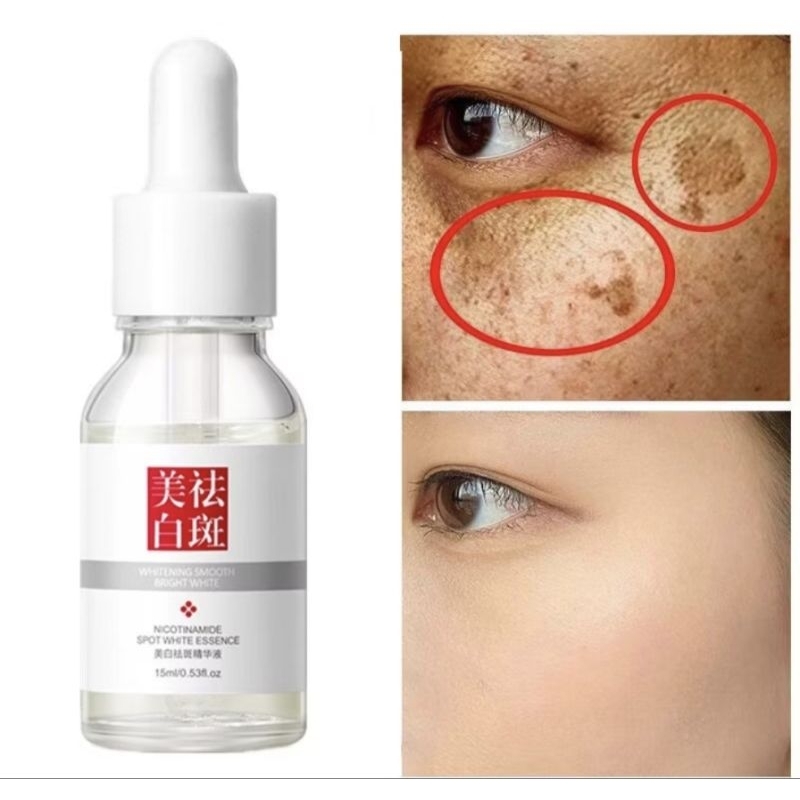 SERUM FUYAN Bright & Glow Whitening Glowing Serum Freckles