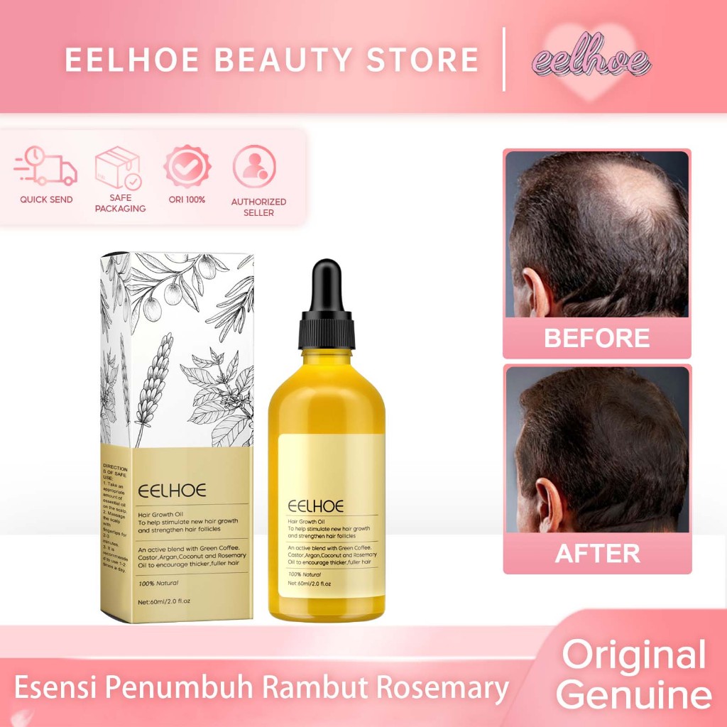 EELHOE Rosemary Oil Rambut Penumbuh Rambut Botak Perawatan Rambut Rontok Penumbuh Rambut Cepat Hair 