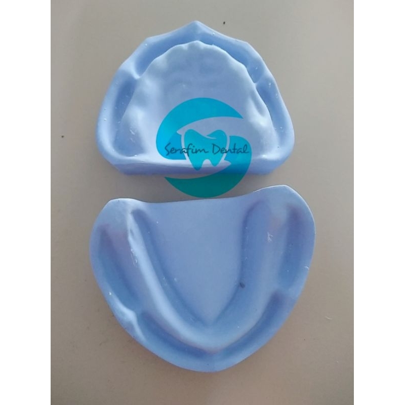 MODEL GIGI GIPS OMPONG