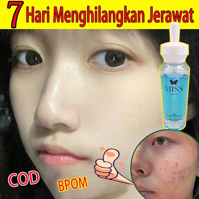 【BPOM】MISS YOUTH SERUM ANTI JERAWAT DAN BEKAS-Brightening dan Acne Serum 30ml jerawat dan bekas jera