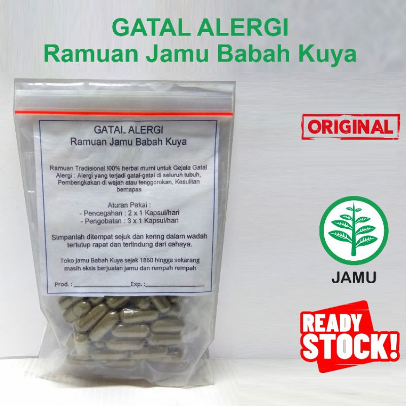 Gatal Alergi Ramuan Jamu Toko Babah Kuya Original gatal-gatal di seluruh tubuh Pembengkakan di wajah