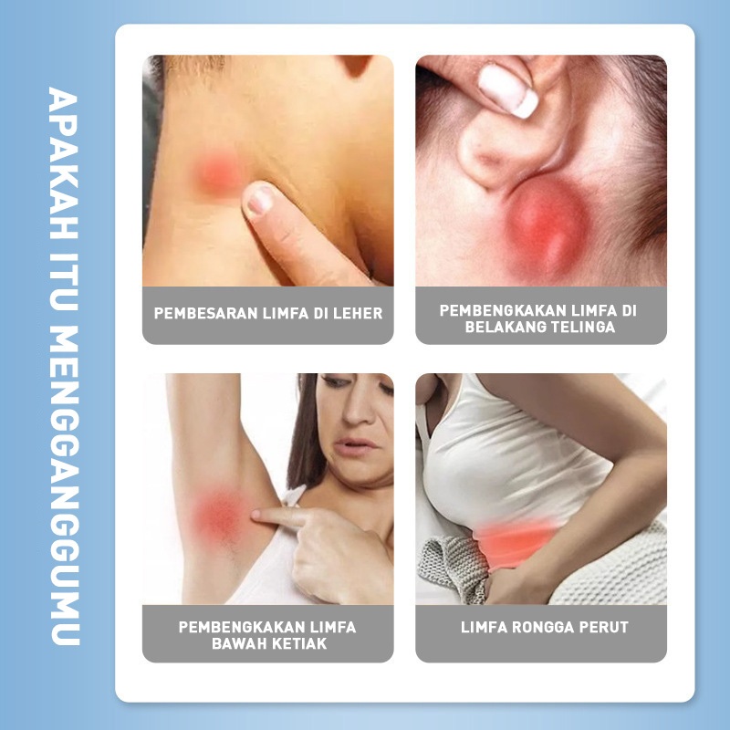 Lymph Node Dissipation, Prunella vulgaris Antibacterial Cream, Sub Cream, Lymph Node Scattering and 