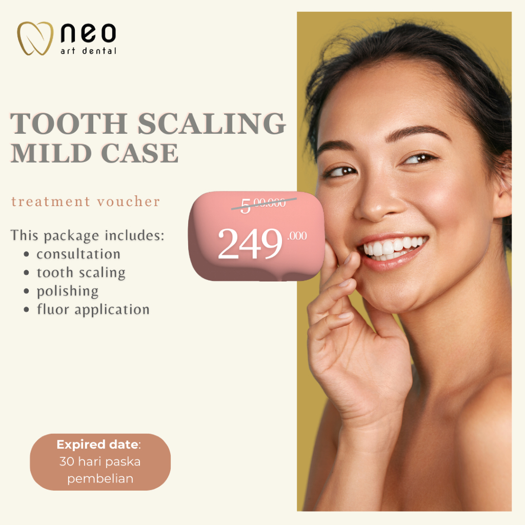 NEO ART DENTAL - VOUCHER PEMBERSIHAN KARANG GIGI KASUS RINGAN / MILD + POLISHING + FLOURIDE