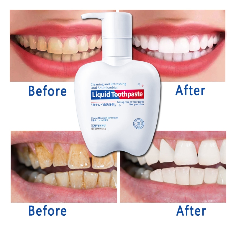 odol pemutih gigi dan karang gigi/pembersih karang gigi/pemutih gigi/pembersih gigi kuning dan karan